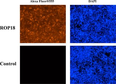 ROP18-Mediated Transcriptional Reprogramming of HEK293T Cell Reveals New Roles of ROP18 in the Interplay Between Toxoplasma gondii and the Host Cell